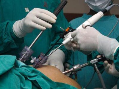 operace-zaludku operace-zaludku