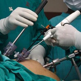 operace-zaludku operace-zaludku